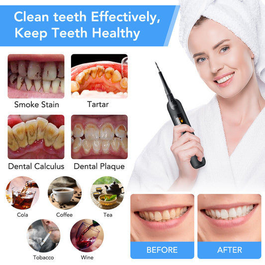 OralSavvy High-Frequency Electric Dental Calculus Remover | Best Selling