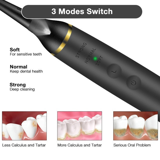 Plaque Remover for Teeth, Electric Tooth Cleaner Tartar Remover for Teeth with LED Light OralSavvy
