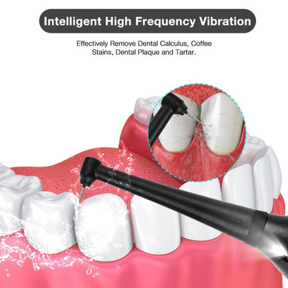 Plaque Remover for Teeth, Electric Tooth Cleaner Tartar Remover for Teeth with LED Light OralSavvy