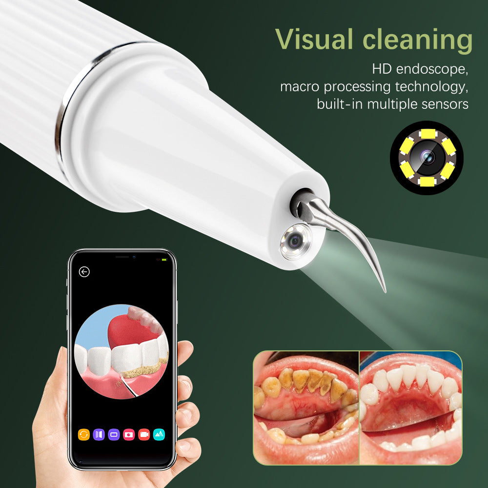 Visual Ultrasonic Removal Of Dental Calculus Best Vibrating Flosser OralSavvy